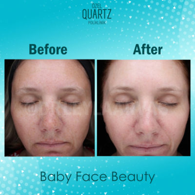 babyfacebeauty